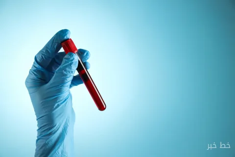 اختبارات دم جديدة لمرض الزهايمر تساعد في التشخيص المبكر